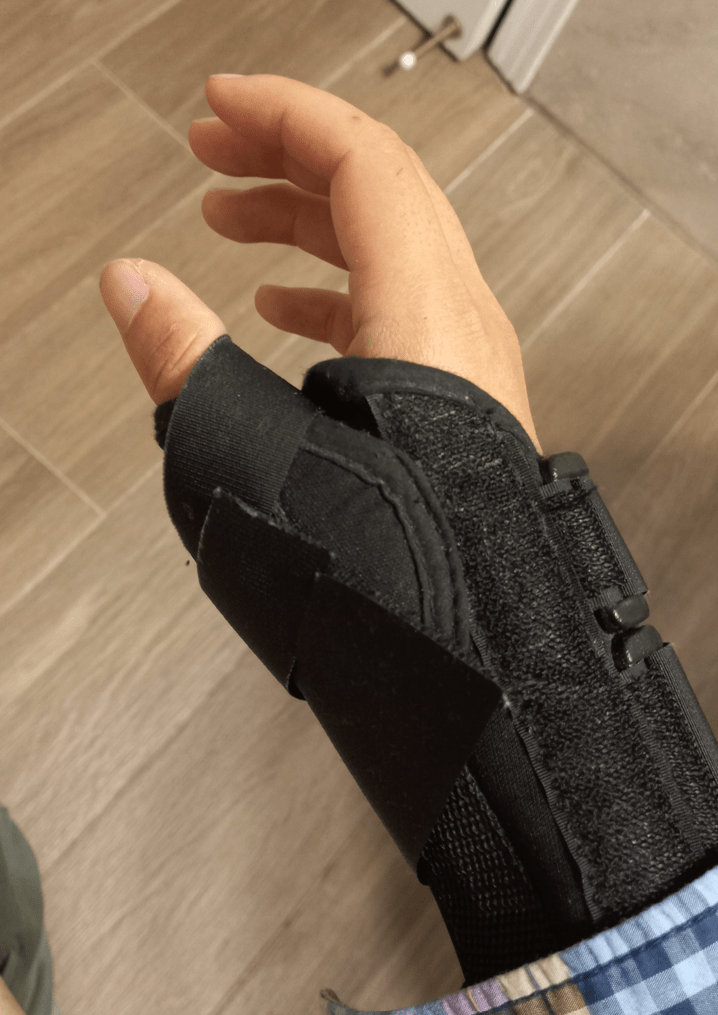 Image of the right hand, with a black wrist brace wrapped around the hand.